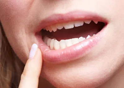 Туапсинская стоматологическая поликлинника | Медицинская профилактика