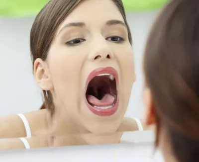 Слизистая полости рта — особенности и строение — Стоматология «Доктор  НеболитЪ»
