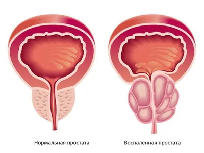 ᐉ Боль в промежности. Лечение причин у женщин, мужчин в Киеве