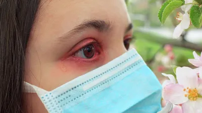 Ожоги, ушибы и травмы глаз: как оказать первую помощь / «Особый взгляд» -  портал для людей, которые видят по-разному