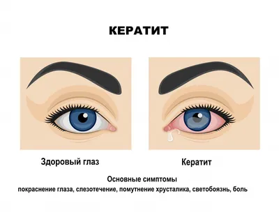 7 привычек для здорового зрения | Клиника микрохирургии \"Глаз\" им. С.  Федорова