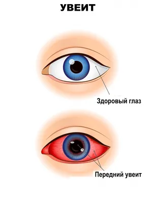 Презентация на тему: \"Заболевания придаточного аппарата глаза\"