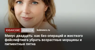 2 шт. отбеливающий крем для лица, удаление мелазмы, темные возрастные пятна,  веснушки, пятна от солнечных ожогов, пигмент меланин, уход за кожей –  лучшие товары в онлайн-магазине Джум Гик