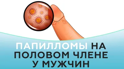 Вирус папилломы человека у мужчин | Врач-гинеколог Мушастикова Ольга  Владимировна