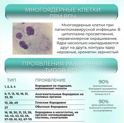 Удаление папиллом лазером в Киеве: Цена от 250 грн