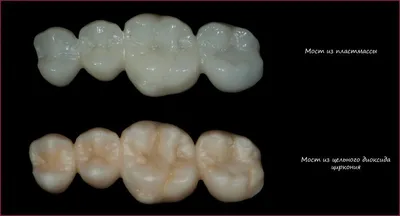 Временные коронки на зубы в Кемерово от 1500 рублей