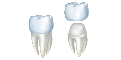 Коронка на жевательный зуб цена