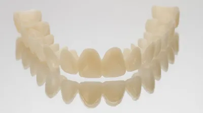 Циркониевые коронки на передние зубы - примеры работ стоматологии KANO