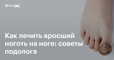 Лечение вросшего ногтя титановой нитью в Красноярске | Бархатный сезон