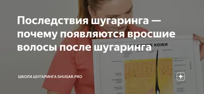 Постоянно врастают волосы в зоне бикини после шугаринга. Что делать? Как  лечить вросшие волосы в зоне бикини после депиляции.