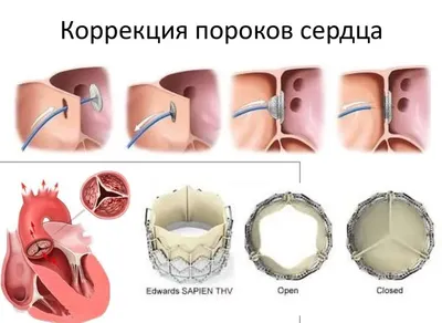 В Педиатрическом университете спасли ребёнка с редким врожденным пороком  сердца - Новости Педиатрического университета