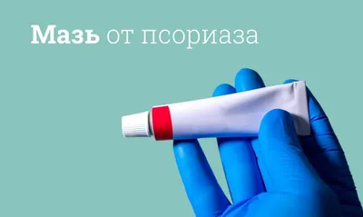 Типы псориаза Крапивницы кожи, заболевания Derma Иллюстрация вектора  крупного плана медицинская Иллюстрация вектора - иллюстрации насчитывающей  иммуно, дерматология: 124717703