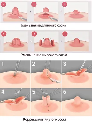 Что делать если у вас втянутые соски? Проблема втянутых и плоских сосков -  YouTube