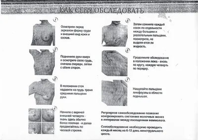 Cамарская Городская больница №4 г.Самары Новости - Симптомы рака молочной  железы