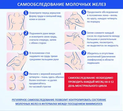 Меланома Юнит Москва - КЛИНИЧЕСКИЙ СЛУЧАЙ Женщине 67 лет. Самостоятельно  обратила внимание на еле заметное втяжение кожи в верхнем наружнем  квадранте молочной железы. Соответственно, на незначительную ассиметрию.  Последние обследования были более 3