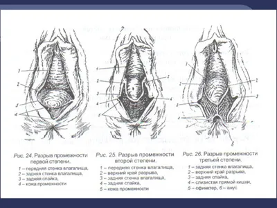 Презентация на тему: Предрасполагающие