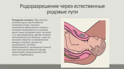 Опущение матки: причины, симптомы и лечение