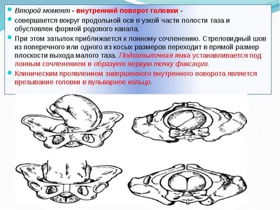 Опущение матки: причины, симптомы и лечение