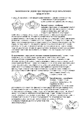 Перинеотомия. Эпизиотомия. Амниотомия - online presentation