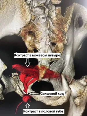 Аномалии развития