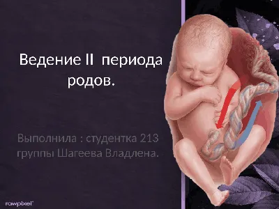 Биомеханизм родов при затылочном предлежании» - презентация, доклад, проект