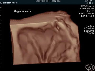 На правах рукописи КРИЖАНОВСКАЯ АННА НИКОЛАЕВНА ПАТОГЕНЕЗ И Р