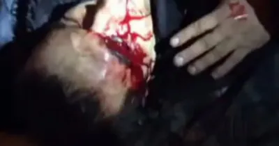Беркут\" тоже смертен: во время штурма Майдана у одного спецназовца выбит  глаз, у другого - оторвана рука (ФОТО) — DSnews.ua