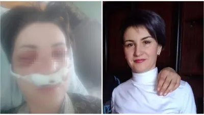 Хотел убить\": бывший муж выбил глаз и раздробил нос жительнице  Карагандинской области