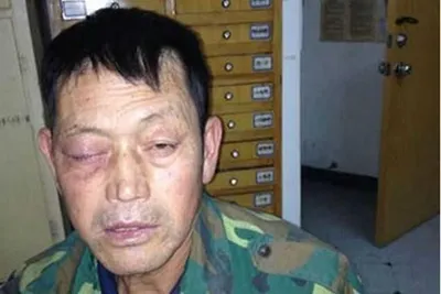 Под Киевом пьяный мужчина выбил другу глаз | НашКиїв.UA