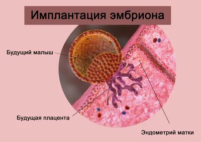 Аймекен Сагира Энгельсовна - Добрый день, мои хорошие! ☝🏻Внематочная  (эктопическая) беременность — патология, при которой эмбрион закрепляется  за пределами полости матки. В 98 % случаев местом имплантации эмбриона  становится фаллопиева труба. ⠀