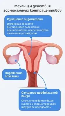 Эндометрит | Полезное от клиники «Геном» в Волгограде