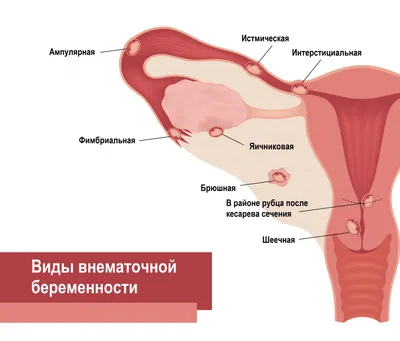 Снятие швов в стоматологии в Люберцах | Когда снимать швы с десны?