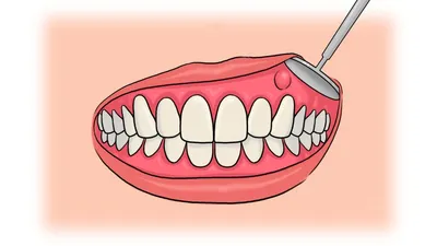 О стоматологии и не только...: Расширение верхней челюсти. Лечение  брекетами.
