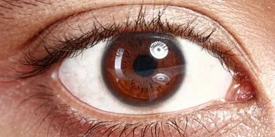 Выявляем болезни по глазам. 9 симптомов серьезной болезни. | Сила и  Здоровье | Дзен