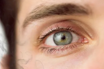 Болезни глаз у пожилых людей: как избежать проблем и предотвратить  заболевания. - Всё о зрении.