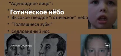 Логопед, нейропсихолог Новочеркасск on Instagram: \"Сегодня на диагностике  очередное готическое нёбо. Это уже третье за год... Ох 😒 Готическое нёбо –  это аномалия развития верхней челюсти, характеризующаяся высоким  аркообразным сводом твердого неба.