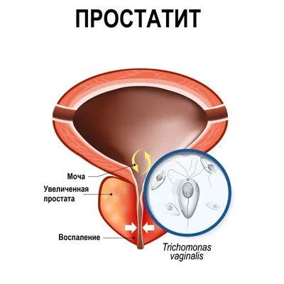 Сыпь на головке члена: причины, симптомы и лечение | Новости Здоровья