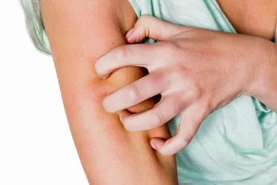Бляшки на коже - причины появления, при каких заболеваниях возникает,  диагностика и способы лечения