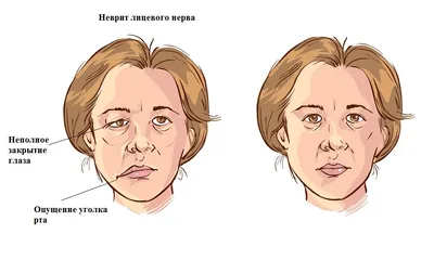 Виды дерматита (фото) - атопический, контактный, себорейный и другие виды  дерматита