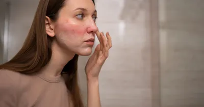 Как болезни печени изменяют нашу кожу? — ThePharma.Media