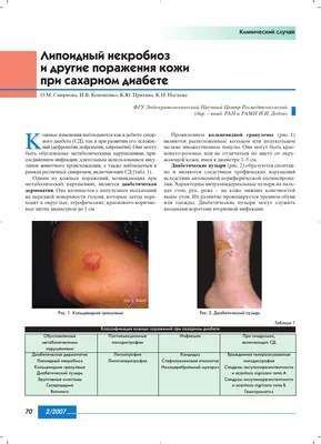 Липоидный некробиоз и другие поражения кожи при сахарном диабете – тема  научной статьи по клинической медицине читайте бесплатно текст  научно-исследовательской работы в электронной библиотеке КиберЛенинка