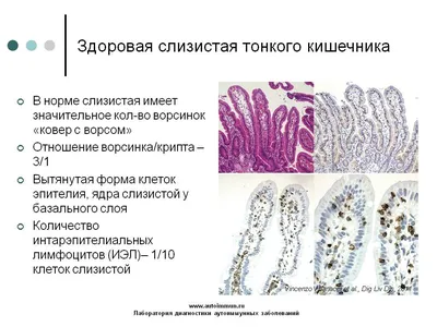 Травяной чай для слизистых ЖКТ — Ярослав Павлов на TenChat.ru