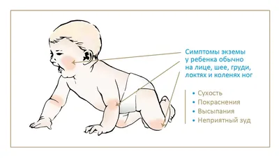 Высыпания у новорожденного: причины и первая помощь