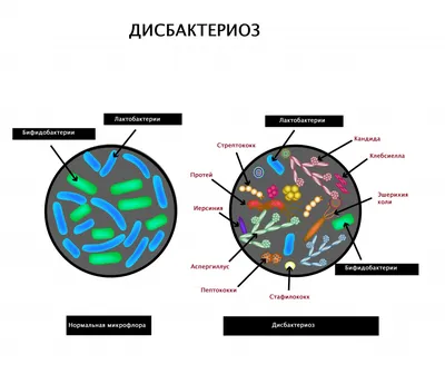 Дисбактериоз кишечника симптомы и лечение у взрослых