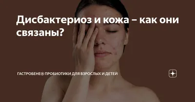 Лечение дисбактериоза кишечника 🌿 Читайте в блоге shop.anti-aging.ua:  Нутрицевтики, диетические добавки