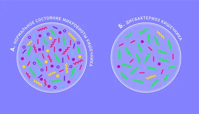 Дисбактериоз - причины, симптомы, диагностика, лечение и профилактика