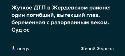 Челябинские врачи вернули зрение модели, у которой вытек глаз - Российская  газета