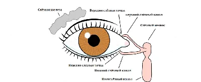 Дакриоцистит. Воспаление слёзного мешка. Барселона. ICR