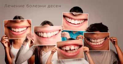 Лечение десен зубов - лечение пародонтита, лечение пародонтоза десен |  Пародонтология в Москве