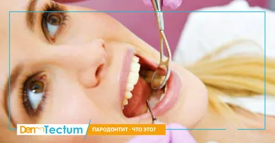 Как предотвратить болезни десен: 5 рекомендаций стоматолога | Стоматология  ROOTT | Дзен